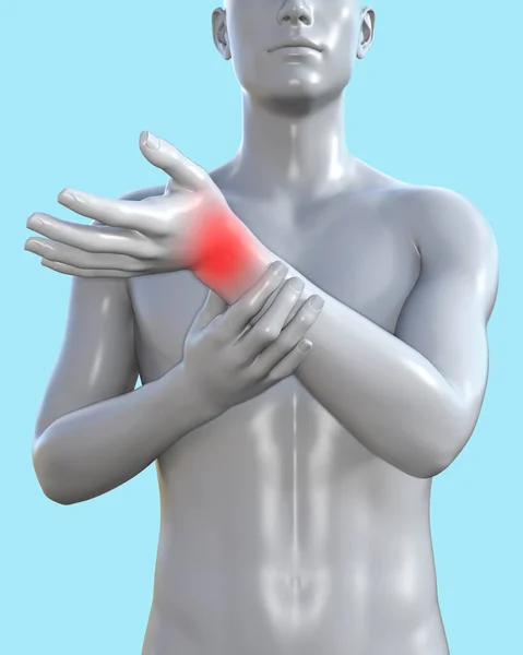3d render illustration of male figure with red inflammated wrist area on blue background, traumatology clinic concept.