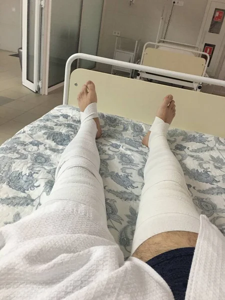 Jambes enveloppées dans des bandages après la chirurgie à l'hôpital — Photo