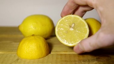 Vitiligo 'lu el limonu sıkar.