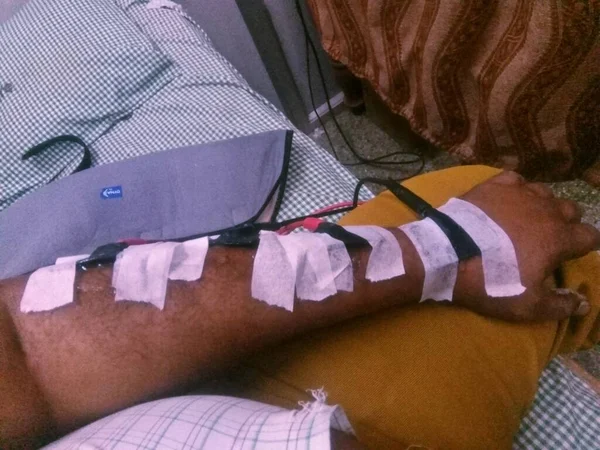 Ağrı kesiciler için fizyoterapi.