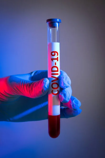 医生手上的医用试管中的验血与考拉韦病毒感染 — 图库照片