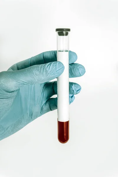 Blodprov Ett Medicinskt Provrör Läkares Hand Vit Bakgrund — Stockfoto