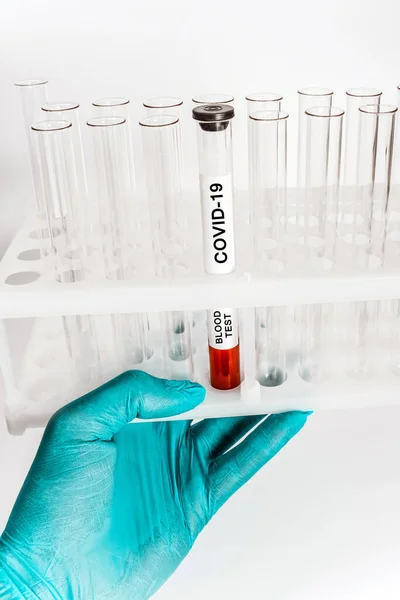 Blodprov Med Coronavirusinfektion Ett Medicinskt Provrör Ett Medicinskt Provrörsställ — Stockfoto