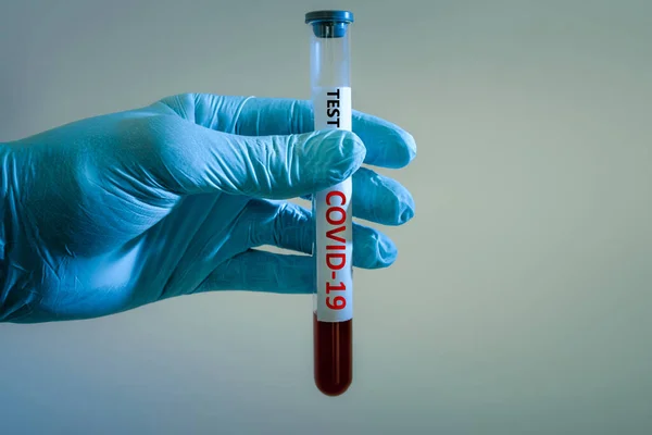 灰度背景下医生手上的医用试管中的验血与考拉韦病毒感染 — 图库照片