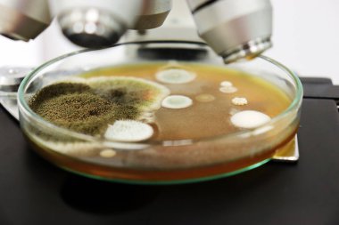Yakın çekim mikroskobu mantarları, kalıpları ve mantarları Petri kabında Malt Extract Agar ile inceledik. klinik örneklerden testleri izole etmek ve geliştirmek için, hava odasındaki kirliliği araştırmak için..