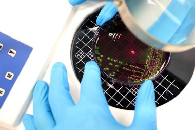 Bilim adamları Escherichia coli (E.coli) bakteri kolonisinin Petri kabında Eosin Methylene Blue (EMB) Agar ile kültürünü saydılar..