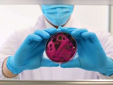 Bilim adamı Escherichia coli (E.coli) kültürünü Petri kabında Eosin Metilen Blue (EMB) Agar ile inceleyerek, tıbbi laboratuvarda azot eldivenleriyle el ele tutuşan metalik yeşil parıldayan kolonileri gösterdi..