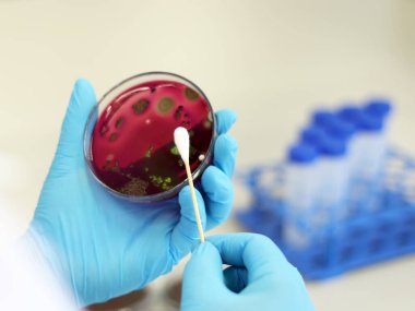 Bilim adamları Escherichia coli (E.coli) kültürünün Petri kabında Eosin Methylene Blue (EMB) Agar ile birlikte analizine göre metalik yeşil parıldayan koloniler, pamuklu pamuklu nitril eldivenlerle el ele tutuşuyorlar..