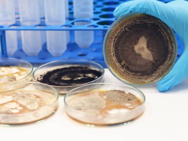 Siyah maya, küf ve mantar testi klinik numunelerini izole etmek ve yetiştirmek için Petri kabında malt özü Agar, tıbbi laboratuvar analizlerinde mavi nitril eldivenli bilim adamını tutuyor..