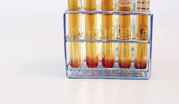 食品サンプル中の大腸菌は 最も可能性の高い数 Mpn 技術を使用して試験を行いますダーラムチューブで試験管黄色溶液中のトリプトースラウリルスープで培養大腸菌 ストック画像