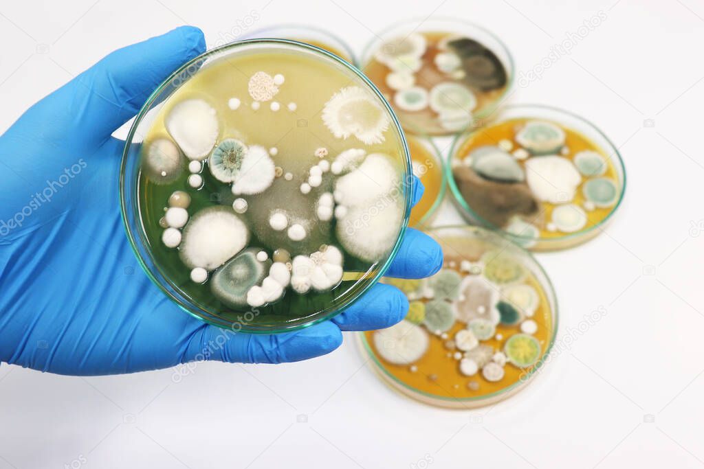 Malt Extract Agar in Petri dish use for growth media to isolate and cultivate yeasts, molds and fungal testing clinical samples, hold in scientist hands in medical health laboratory analysis disease.