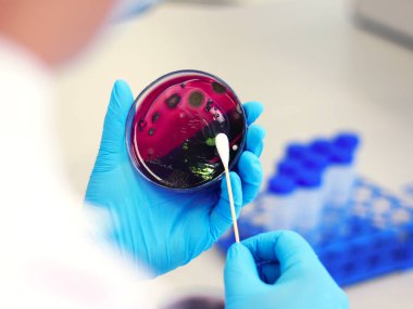 Bilim adamları Escherichia coli (E.coli) kültürünün Petri kabında Eosin Methylene Blue (EMB) Agar ile birlikte analizine göre metalik yeşil parıldayan koloniler, pamuklu pamuklu nitril eldivenlerle el ele tutuşuyorlar..