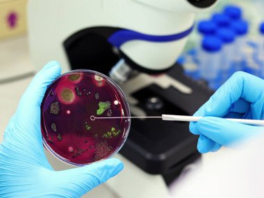 Bilim adamları Escherichia coli (E.coli) kültürünün Petri kabında Eosin Metilen Blue (EMB) Agar ile birlikte analizine göre metalik yeşil parıldayan koloniler, döngü aşılamalı nitril eldivenlerle el ele tutuşuyorlar..