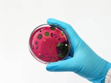 Petri kabında Eosin Methylene Blue (EMB) Agar kültürü ile Escherichia coli (E.coli) bilimadamı testi, beyaz arka planda izole edilmiş nitril eldivenlerle el ele tutuşan metalik yeşil parıltı kolonisini gösteriyor..