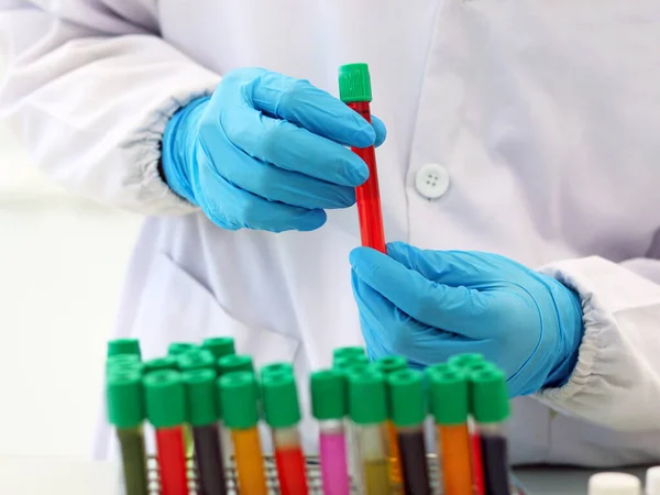 Cell-culture tube with red blood solvent test solution handle in scientist hands wear nitrile blue gloves and PPE, with colorful culture cell tubes, biotechnology analysis experiment for anti-virus.