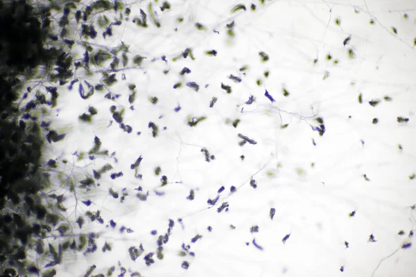 Visão Microscópica Esporos Fungos Pretos Moldes Leveduras Com Lente Macro — Fotografia de Stock
