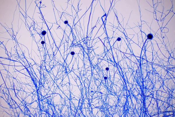 Microscopio Cepa Esporas Hongos Negros Con Algodón Lactofenol Azul Moldes Fotos de stock libres de derechos