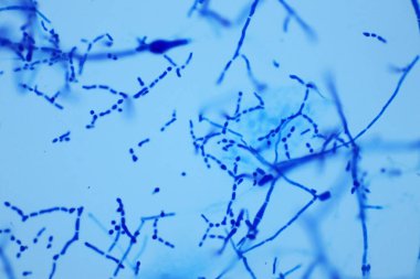 Lactophenol pamuk mavisi mikroskop, makro 40x mercekli mantar ya da maya, hava odasında kirlilik, kirlilik havası çevresi. Mikrobiyoloji laboratuvarı kavramları.