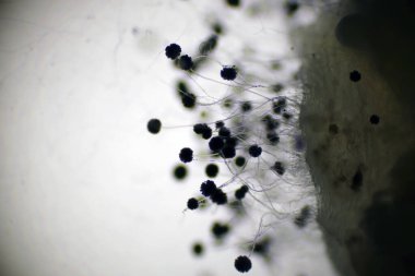 Siyah mantar sporunun mikroskop görüntüsü, makro 40x lensli mantar ya da maya kalıpları, hava odasındaki kirlilik, çevre kirliliği. Mikrobiyoloji laboratuar kavramları, kopyalama alanına sahiptir.