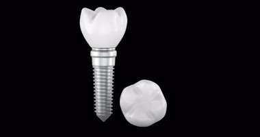 Seramik kaplamalı iki diş implantı. Döndürme animasyonu kusursuz bir şekilde çevrilebilir. Şeffaf arkaplanda 3B görüntüleme izole edildi