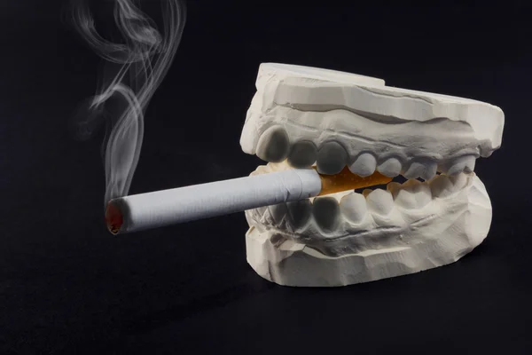 Teeth and cigarettes — Stock Photo, Image