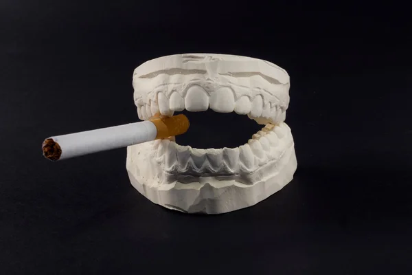 Teeth and cigarettes — Stock Photo, Image