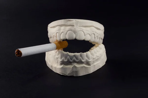 Denti e sigarette — Foto Stock