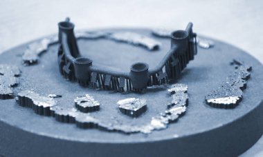 Nesne lazer sindirim makinesine yazdırıldı