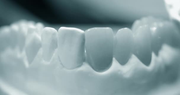 Modelo de dentes humanos com dentes artificiais close-up — Vídeo de Stock