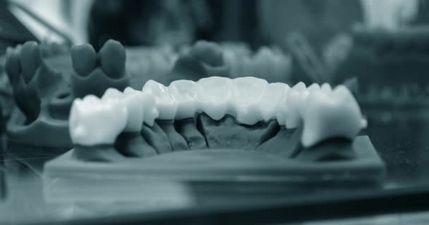 O homem da mandíbula inferior, criado em uma impressora 3d a partir de um fotopolímero — Vídeo de Stock