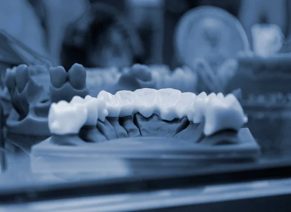 La mandíbula inferior de un hombre, creado en una impresora 3D a partir de un material fotopolímero — Foto de Stock