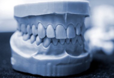 Fotopolimer 'in 3d yazıcısına yazdırılmış bir adamın üst ve alt çenesi.