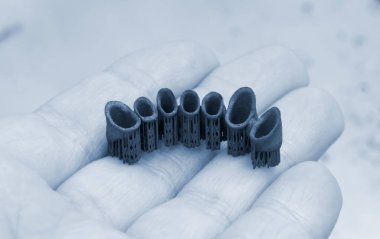 Metal için 3D yazıcıda diş kaplaması oluşturuldu