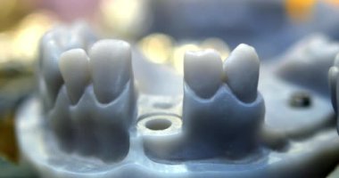 Stereolitografi 3D yazıcıya yazdırılmış nesneler