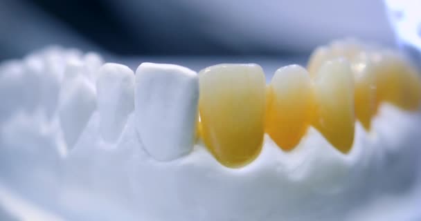 Primer plano de un modelo dental. Modelo de dientes humanos con dientes artificiales — Vídeo de stock