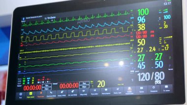 Ultrason görüntüsü yakın planda. Ultrason görüntüsü. Tarayıcı kullanarak ultrason muayenesi. Ekokardiyografi. Kişinin Ultrasonografi Analizi Taraması. Ultrason Tarama Aygıtı.