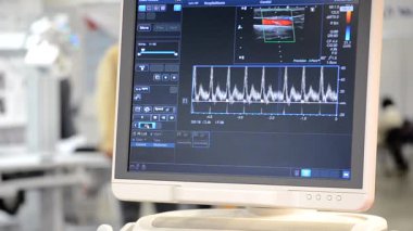 Ultrason görüntüsü yakın planda. Ultrason görüntüsü. Tarayıcı kullanılıyor. Kişinin Ultrasonografi Analizi Taraması. Ultrason muayenesi. Ultrason Tarama Cihazı. Ekokardiyografi.