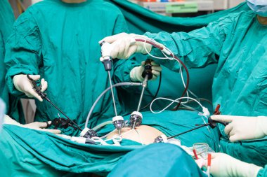 Cerrahlar ameliyat sırasında elleri laparoskopik karın ameliyatı sırasında ameliyathanede.