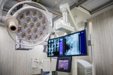 Ameliyat lambası ve bilgisayar röntgen odasında bulanık röntgen filmi olduğunu gösteriyor.