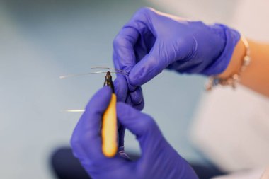 Diş hekimi hastaya diş teli takar. Yakın plan.