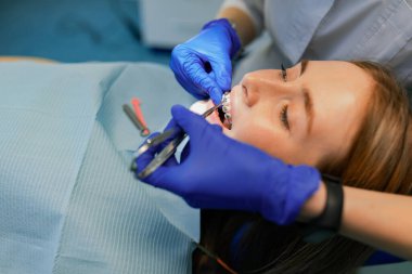 Diş hekimi hastaya diş teli takar. Yakın plan.