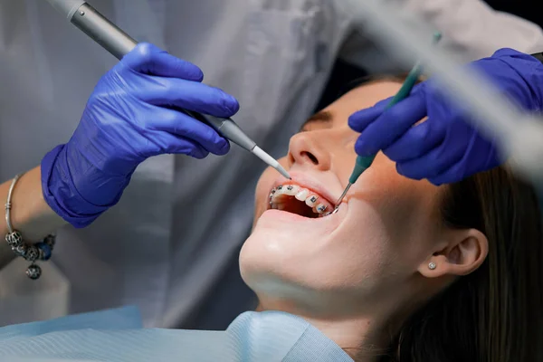 Diş Hekimi Hastaya Diş Teli Takar Yakın Plan — Stok fotoğraf