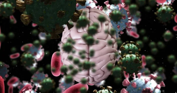 Komórki Koronawirusowe Unoszące Się Nad Komputerowo Wygenerowanym Ludzkim Mózgiem Covid — Zdjęcie stockowe