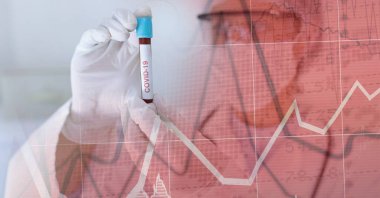 Yüz maskesi ve kovid 19 tüp kan örneğiyle tıbbi veri işleme bileşimi. küresel covid 19 salgın hastalık, ilaç, dijital arayüz ve dijital olarak oluşturulan veri işleme kavramı.