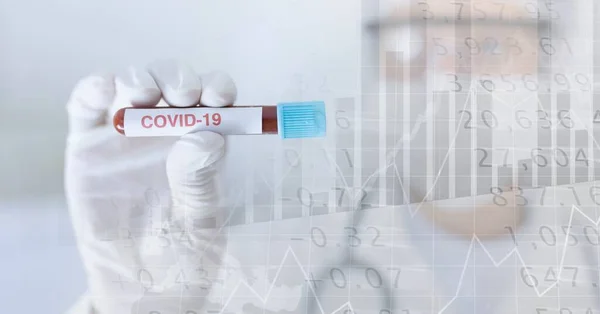 Sammansättning Medicinska Data Bearbetning Över Ansiktsmask Och Covid Röret Blodprov — Stockfoto