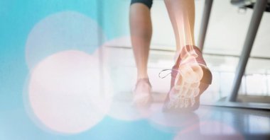 Koşu bandında koşan, bacak kemikleri görünen ve ışık lekeleri olan bir kadın kompozisyonu. egzersiz ve yaralanma konsepti dijital olarak oluşturulmuş görüntü.