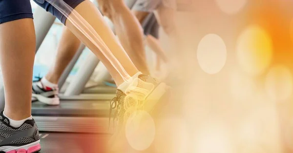 Composition of woman\'s leg with bones showing exercising on treadmill with spots of light. active lifestyle and injury concept digitally generated image.