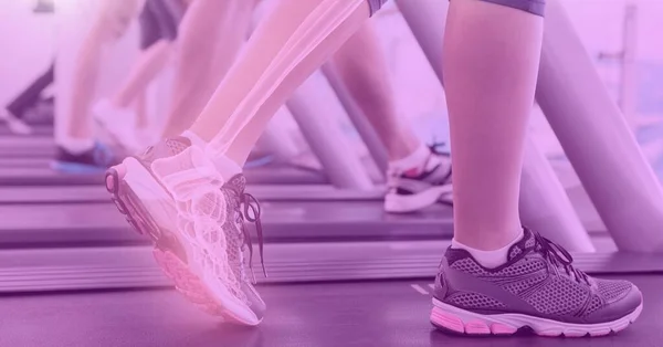 Composição Das Pernas Mulher Exercitando Esteira Rolante Com Ossos Raios — Fotografia de Stock