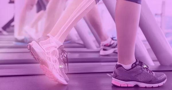 Futópadon Mozgó Női Lábak Összetétele Látható Röntgencsontokkal Rózsaszínnel Technológia Sport — Stock Fotó