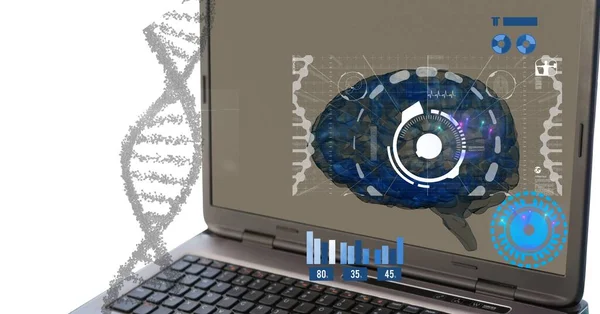 Composición Del Cerebro Humano Procesamiento Datos Médicos Través Computadora Portátil —  Fotos de Stock